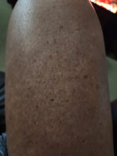 Foto da avaliação de Kátia D.